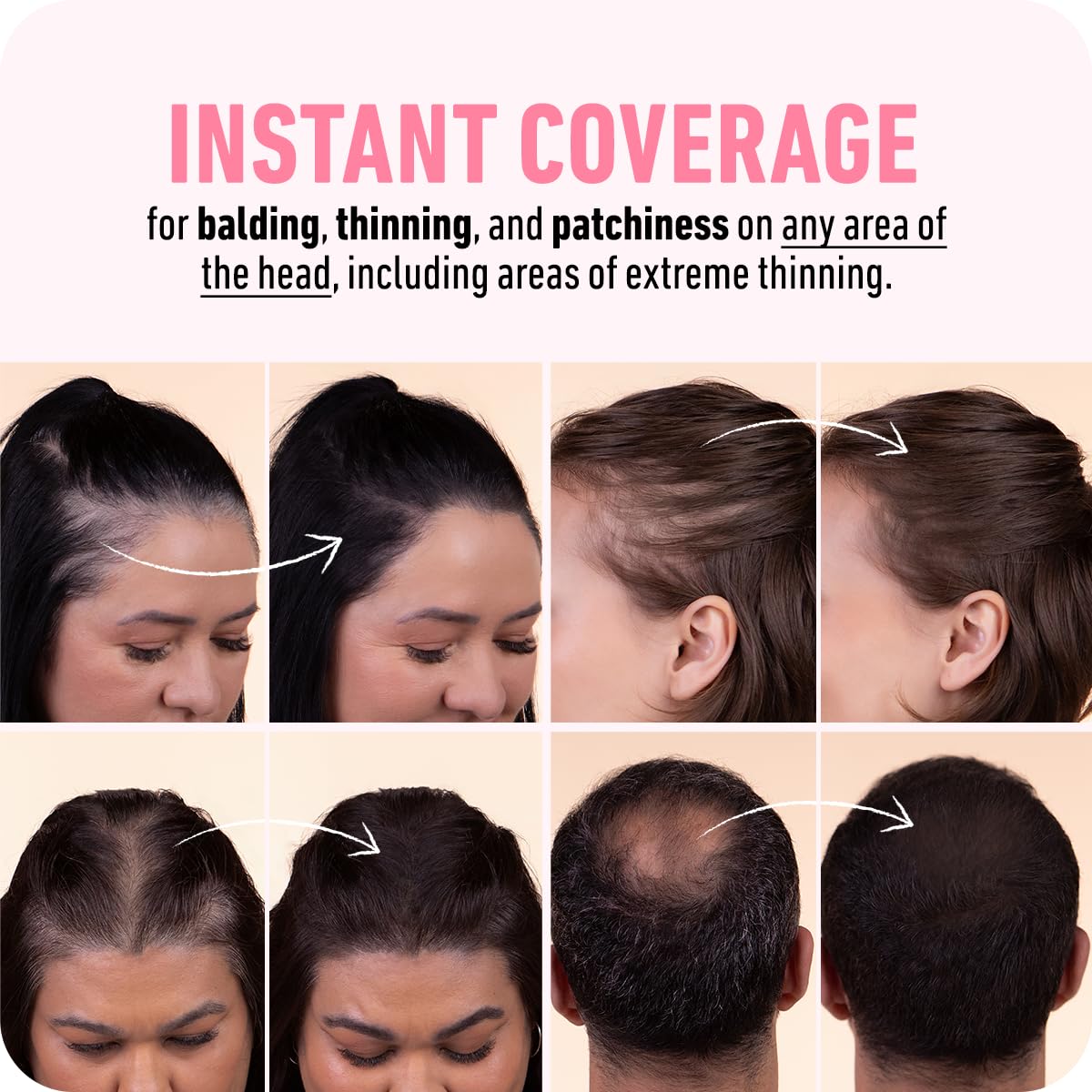 Hairline Powder - Root Touch up Hair Color for Gray Coverage - Bald Spot Concealing Hair Powder for Women & Men - 24-Hour Stain-Proof - Auburn